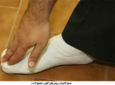گزیده احکام رساله مصور جانبازان؛ احکام وضو (4) مسح روی پای گچ گرفته گزیده احکام رساله مصور جانبازان؛ احکام وضو (4) مسح روی پای گچ گرفته